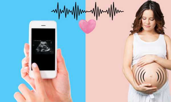 Best Apps to Monitor Your Baby’s Heartbeat at Home